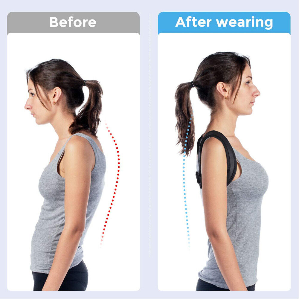 Adjustable Posture Corrector – Back Brace & Clavicle Support