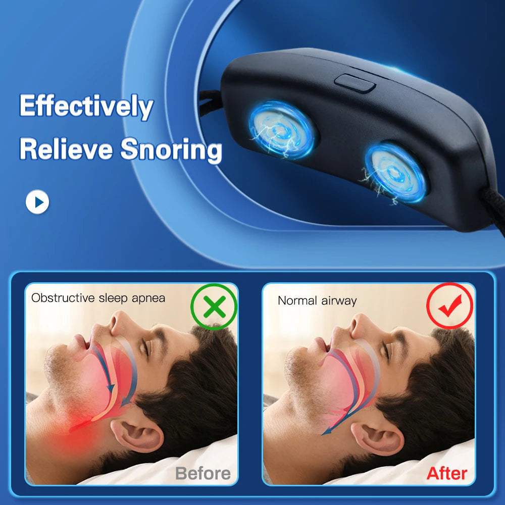EMS Anti-Snore Sleep Aid Device