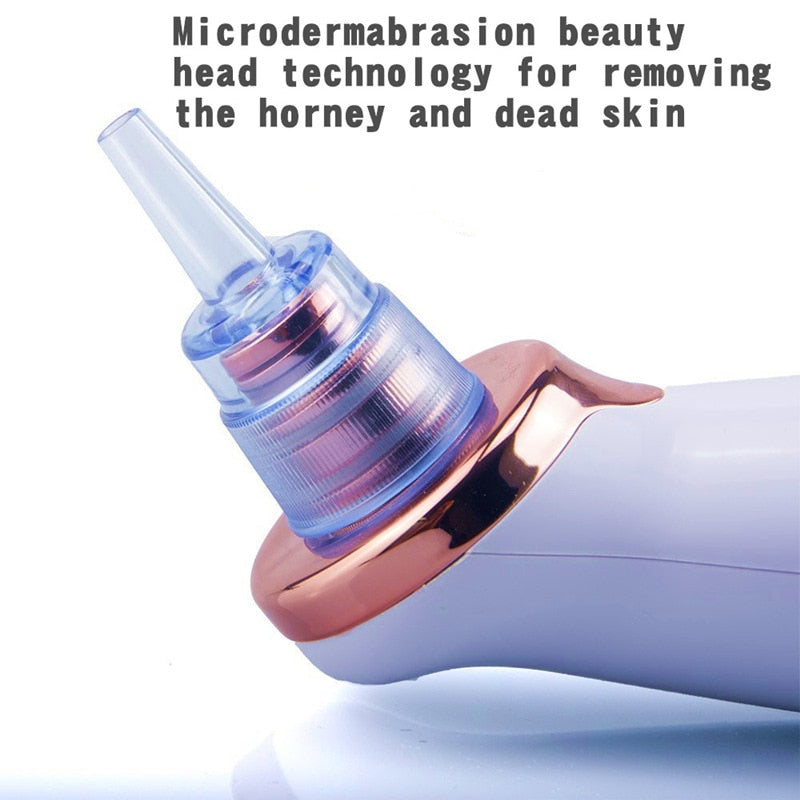 Electric Blackhead Remover Vacuum