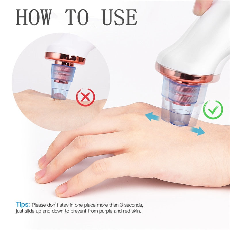 Electric Blackhead Remover Vacuum