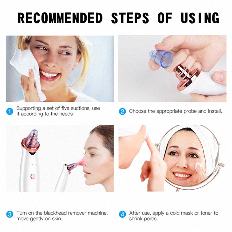 Electric Blackhead Remover Vacuum